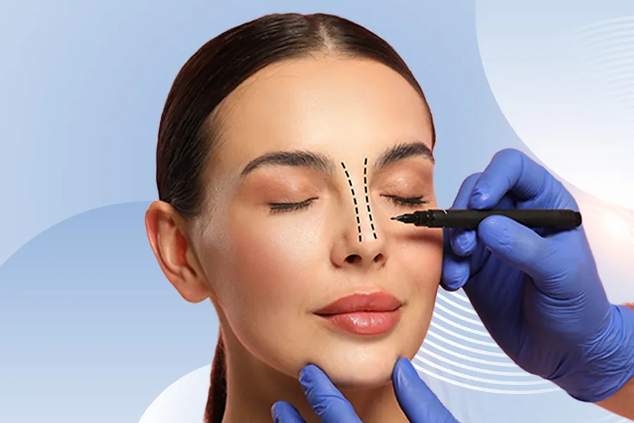 Nasenästhetik (Rhinoplastik)