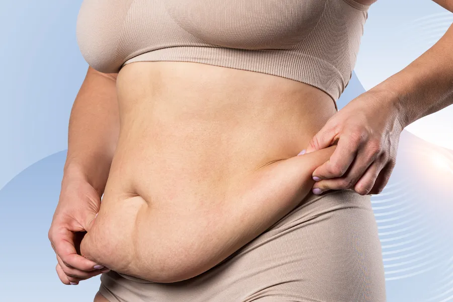 Bauchstraffung (Abdominoplastik)
