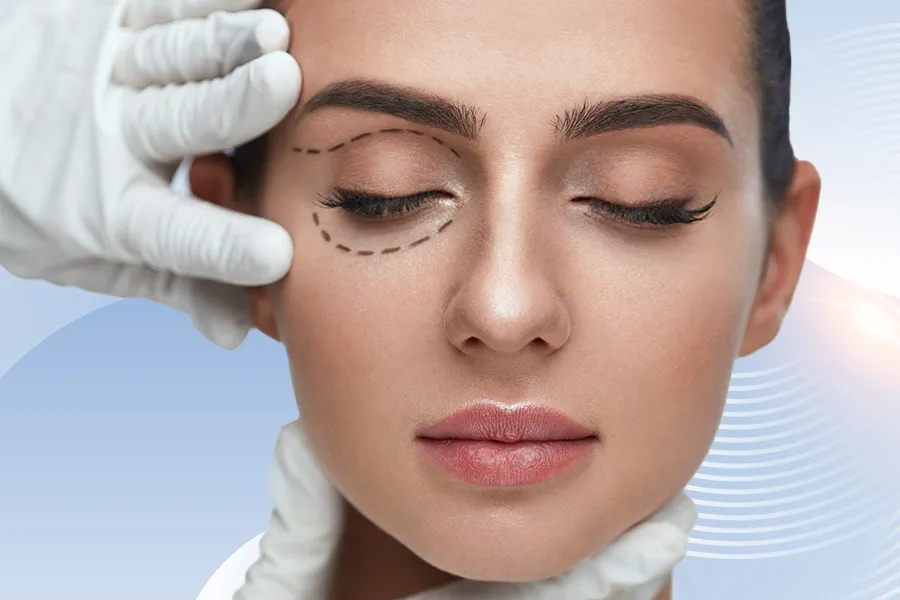 Ober- und Unterlidstraffung (Blepharoplastik)