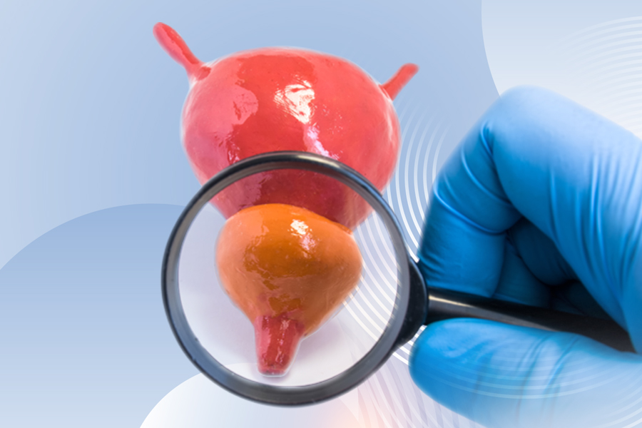 Non-Surgical Prostate Cancer Treatment